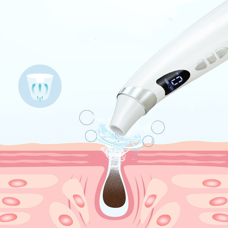 Electric Visual Blackhead Suction Instrument Household Cleansing Pore Cleaner For Skin Equipment Skin Care Tool 🇨🇳