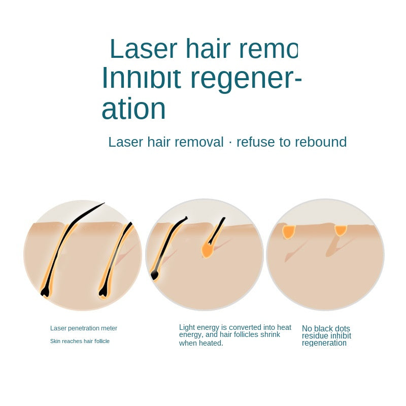 Home Hold Depilatory Laser Mini Hair Epilator Permanent Hair Removal IPL System 990000 Shot Light Pulses Whole Body Hair Remover 🇨🇳